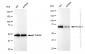 KD-Validated Anti-ACSL4 Rabbit Monoclonal Antibody